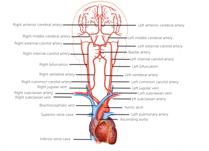 2. Carotid Ultrasound - Anatomy | 123 Sonography